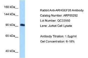 WB Suggested Anti-ARHGEF26 Antibody Titration: 0. (SGEF 抗体  (N-Term))