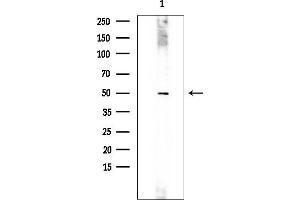anti-Interleukin 23 Receptor (IL23R) (N-Term) antibody