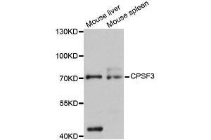 Western blot analysis of extracts of various cell lines, using CPSF3 antibody (ABIN5997506) at 1:3000 dilution. (CPSF3 抗体)