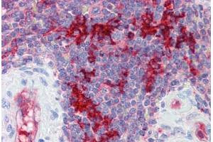 Human Spleen (formalin-fixed, paraffin-embedded) stained with RAE1 antibody ABIN462225 followed by biotinylated goat anti-rabbit IgG secondary antibody ABIN481713, alkaline phosphatase-streptavidin and chromogen. (RAE1 抗体  (C-Term))