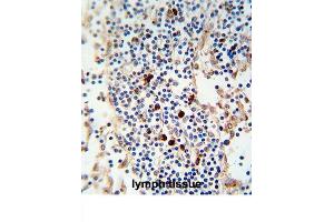 Immunohistochemistry (IHC) image for anti-kappa Light Chain antibody (ABIN2995397)