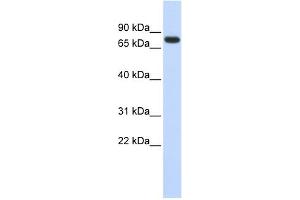 WB Suggested Anti-ANKRD13B Antibody Titration: 0. (ANKRD13B 抗体  (Middle Region))