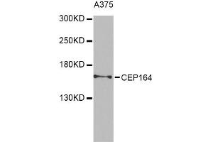 Western blot analysis of extracts of A-375 cells, using CEP164 Antibody.