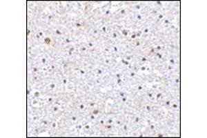 Immunohistochemistry of PD-1 in Human brain tissue with AP30650PU-N PD1 antibody at 2. (PD-1 抗体  (C-Term))