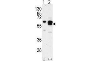 Western blot analysis of CAMK1G (arrow) using rabbit polyclonal CAMK1G Antibody (C-term) .