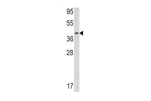 Western blot analysis of Calponin-3 antibody (Center) (ABIN390504 and ABIN2840860) in NIH-3T3 cell line lysates (35 μg/lane). (CNN3 抗体  (AA 129-158))