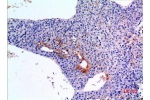 Immunohistochemistry (IHC) image for anti-Bone Morphogenetic Protein 3 (BMP3) (C-Term) antibody (ABIN3187822)