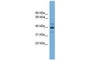 Image no. 1 for anti-BCL2/adenovirus E1B 19kD Interacting Protein Like (BNIPL) (AA 251-300) antibody (ABIN6746355) (BNIPL 抗体  (AA 251-300))