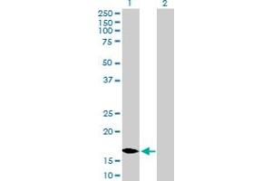 Western Blot analysis of MCEE expression in transfected 293T cell line by MCEE MaxPab polyclonal antibody. (MCEE 抗体  (AA 1-176))
