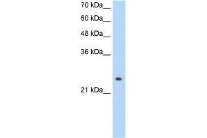 WB Suggested Anti-ADH6 Antibody Titration:  1. (ADH6 抗体  (Middle Region))