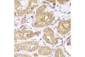 Immunohistochemistry of paraffin-embedded human kidney using RPS4X antibody at dilution of 1:100 (x400 lens). (RPS4X 抗体)