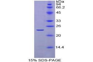 SDS-PAGE analysis of Chicken Noggin Protein. (NOG 蛋白)