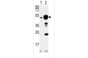Western blot analysis of EIF4A1 (arrow) using rabbit polyclonal EIF4A1 Antibody (N-term) (ABIN391393 and ABIN2841397). (EIF4A1 抗体  (N-Term))