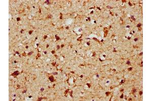 IHC image of ABIN7152772 diluted at 1:289 and staining in paraffin-embedded human brain tissue performed on a Leica BondTM system.
