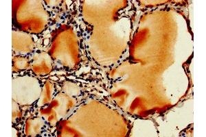 IHC image of ABIN7142736 diluted at 1:250 and staining in paraffin-embedded human thyroid tissue performed on a Leica BondTM system. (RPL11 抗体  (AA 3-178))