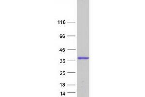Dysbindin (Dystrobrevin Binding Protein 1) Domain Containing 2 (DBNDD2) (Transcript Variant 3) protein (Myc-DYKDDDDK Tag)