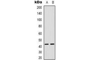 Western blot analysis of MAPKAPK3 expression in Hela (A), Jurkat (B) whole cell lysates. (MAPKAP Kinase 3 抗体  (C-Term))