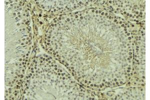 ABIN6269091 at 1/100 staining Mouse testis tissue by IHC-P. (Integrin beta 3 抗体  (C-Term))