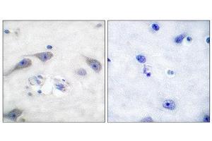 Immunohistochemistry (IHC) image for anti-Protein Phosphatase 1, Regulatory (Inhibitor) Subunit 1B (PPP1R1B) (Thr75) antibody (ABIN1847886) (DARPP32 抗体  (Thr75))