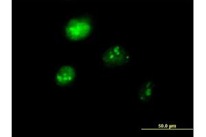 Immunofluorescence of purified MaxPab antibody to IRF1 on HeLa cell.