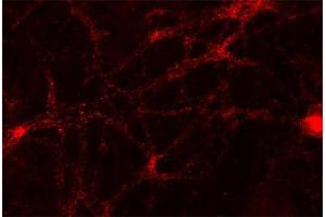 Indirect immunofluorescence labeling of PFA fixed rat hippocampus neurons (dilution 1 : 500).