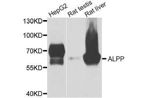 Western blot analysis of extracts of various cell lines, using ALPP antibody. (PLAP 抗体)