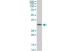 Western Blotting (WB) image for anti-Centromere Protein H (CENPH) (AA 1-247) antibody (ABIN528745)