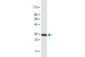 Western Blot detection against Immunogen (31. (PIGW 抗体  (AA 399-447))