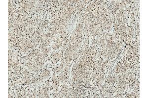 Immunohistochemistry analysis using Rabbit Anti-ATG10 Polyclonal Antibody (ABIN5065897). (ATG7 抗体  (N-Term) (FITC))