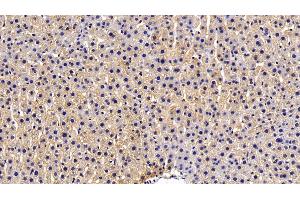 Detection of HIF1a in Rat Liver Tissue using Polyclonal Antibody to Hypoxia Inducible Factor 1 Alpha (HIF1a)