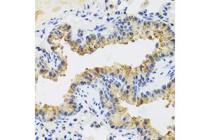 Immunohistochemistry of paraffin-embedded mouse lung using UVRAG antibody at dilution of 1:100 (x40 lens). (UVRAG 抗体)