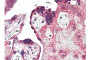 Immunohistochemistry (Paraffin-embedded Sections) (IHC (p)) image for anti-Toll-Like Receptor 3 (TLR3) (C-Term) antibody (ABIN615251)