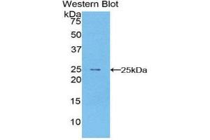 Western Blotting (WB) image for anti-Peripheral Myelin Protein 22 (PMP22) (AA 31-133) antibody (ABIN1860271) (PMP22 抗体  (AA 31-133))