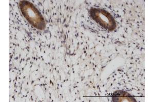 Immunoperoxidase of monoclonal antibody to RAB1B on formalin-fixed paraffin-embedded human endometrium. (RAB1B 抗体  (AA 91-201))