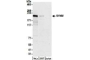 anti-Synemin, Intermediate Filament Protein (SYNM) (AA 1350-1400) antibody