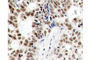 Immunohistochemistry (IHC) image for anti-Breast Cancer 1 (BRCA1) (pSer1423) antibody (ABIN3019881) (BRCA1 抗体  (pSer1423))