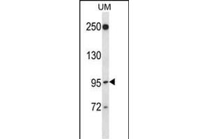 RGL2 Antibody (N-term) (ABIN657382 and ABIN2846427) western blot analysis in uterine tumor cell line lysates (35 μg/lane). (RGL2 抗体  (N-Term))