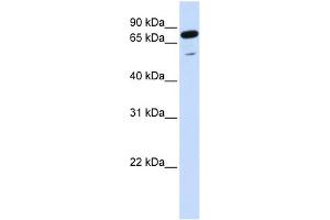 WB Suggested Anti-PPP1R13L Antibody Titration:  0. (PPP1R13L 抗体  (Middle Region))