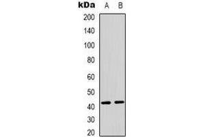 Western blot analysis of PEX10 expression in MCF7 (A), Jurkat (B) whole cell lysates. (PEX10 抗体)