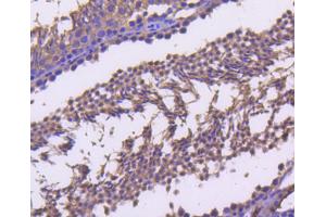 Immunohistochemistry (Paraffin-embedded Sections) (IHC (p)) image for anti-Cyclin B2 (CCNB2) antibody (ABIN5557369)