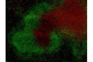 Immunofluorescence (IF) image for anti-T Cell Receptor (TCR) beta (TCR beta) antibody (Alexa Fluor 594) (ABIN2656861) (TCR beta 抗体  (Alexa Fluor 594))