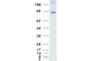 Validation with Western Blot