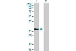 Western Blot analysis of CDKN1B expression in transfected 293T cell line by CDKN1B monoclonal antibody (M02), clone 2F4. (CDKN1B 抗体  (AA 100-198))