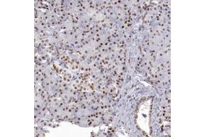 Immunohistochemical staining of human pancreas with TFAP4 polyclonal antibody  shows moderate nuclear positivity in exocrine glandular cells and islet cells. (TFAP4 抗体)