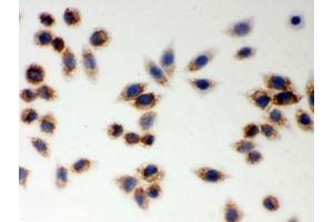 ICC testing of FFPE human SMMC-7721 cells with LYRIC antibody. (MTDH 抗体  (AA 101-270))