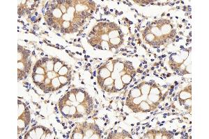 Immunohistochemistry analysis of paraffin-embedded human colon using IL22RA1 Polyclonal Antibody at dilution of 1:200. (IL22 Receptor alpha 1 抗体)