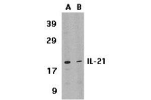 Western Blotting (WB) image for anti-Interleukin 21 (IL21) (Middle Region) antibody (ABIN1030955) (IL-21 抗体  (Middle Region))