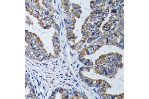 Immunohistochemistry (Paraffin-embedded Sections) (IHC (p)) image for anti-ATP Synthase, H+ Transporting, Mitochondrial F1 Complex, beta Polypeptide (ATP5B) (AA 230-529) antibody (ABIN6137326)