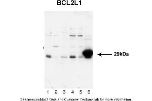 Sample Type: 1. (BCL2L1 抗体  (N-Term))