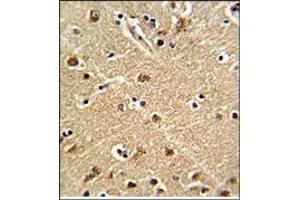Immunohitochemistry: ZWINT Antibody staining of Formalin-Fixed, Paraffin-Embedded Human Brain Tissue. (ZWINT 抗体  (Middle Region))